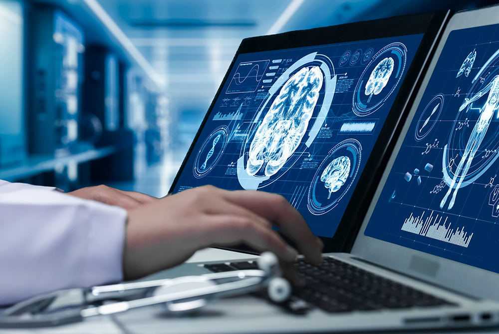 hands typing on a computer keyboard with brain scan imagery on the monitor